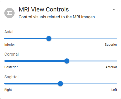 MRI View Controls